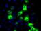 Cytochrome P450 Family 2 Subfamily E Member 1 antibody, NBP2-02155, Novus Biologicals, Immunocytochemistry image 