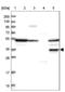 SBDS Ribosome Maturation Factor antibody, NBP1-87070, Novus Biologicals, Western Blot image 