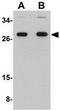 Desumoylating Isopeptidase 2 antibody, GTX85277, GeneTex, Western Blot image 