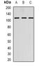 Alanyl-TRNA Synthetase 2, Mitochondrial antibody, orb341368, Biorbyt, Western Blot image 