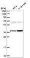 Calcium/Calmodulin Dependent Protein Kinase II Gamma antibody, NBP2-57797, Novus Biologicals, Western Blot image 