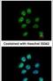 Zinc Finger Protein 143 antibody, PA5-21448, Invitrogen Antibodies, Immunofluorescence image 