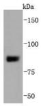 SUZ12 Polycomb Repressive Complex 2 Subunit antibody, A00583-3, Boster Biological Technology, Western Blot image 