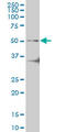 Interleukin 1 Receptor Associated Kinase 4 antibody, LS-C133752, Lifespan Biosciences, Western Blot image 