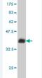 Barrier To Autointegration Factor 1 antibody, H00008815-M05, Novus Biologicals, Western Blot image 