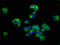 Solute Carrier Family 14 Member 1 (Kidd Blood Group) antibody, LS-C671355, Lifespan Biosciences, Immunofluorescence image 