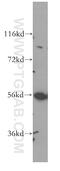 LCK Proto-Oncogene, Src Family Tyrosine Kinase antibody, 12477-1-AP, Proteintech Group, Western Blot image 