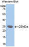 Lysyl Oxidase Like 1 antibody, LS-C300719, Lifespan Biosciences, Western Blot image 