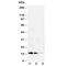 Galectin 1 antibody, R30492, NSJ Bioreagents, Western Blot image 