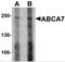 ATP Binding Cassette Subfamily A Member 7 antibody, NBP2-82069, Novus Biologicals, Western Blot image 