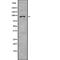 Adhesion G Protein-Coupled Receptor E5 antibody, abx146737, Abbexa, Western Blot image 