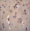 Dystrobrevin Alpha antibody, LS-C167550, Lifespan Biosciences, Immunohistochemistry paraffin image 