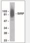 Signal Regulatory Protein Alpha antibody, NBP1-03074, Novus Biologicals, Western Blot image 
