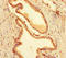 Meis Homeobox 1 antibody, LS-C678638, Lifespan Biosciences, Immunohistochemistry paraffin image 
