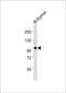 Ubiquitin Like With PHD And Ring Finger Domains 1 antibody, M01156-1, Boster Biological Technology, Western Blot image 