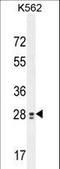 Testis Expressed 13B antibody, LS-C161810, Lifespan Biosciences, Western Blot image 