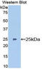Glutathione S-transferase P 1 antibody, LS-C301122, Lifespan Biosciences, Western Blot image 