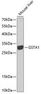 Glutathione S-Transferase Alpha 1 antibody, GTX55650, GeneTex, Western Blot image 