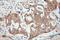 Proteasome Subunit Beta 1 antibody, 11749-1-AP, Proteintech Group, Immunohistochemistry paraffin image 