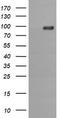 Phosphoinositide-3-Kinase Regulatory Subunit 5 antibody, TA505893S, Origene, Western Blot image 