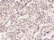 Ataxin 7 Like 1 antibody, 202703-T08, Sino Biological, Immunohistochemistry paraffin image 