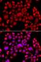 Phosphatidylinositol-5-Phosphate 4-Kinase Type 2 Beta antibody, LS-C747630, Lifespan Biosciences, Immunofluorescence image 