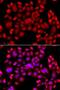 Phosphatidylinositol-5-Phosphate 4-Kinase Type 2 Beta antibody, LS-C747630, Lifespan Biosciences, Immunofluorescence image 