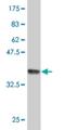 Mex-3 RNA Binding Family Member B antibody, H00084206-M05, Novus Biologicals, Western Blot image 