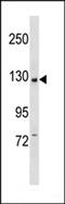 Phosphatidylinositol-4,5-Bisphosphate 3-Kinase Catalytic Subunit Beta antibody, 63-344, ProSci, Western Blot image 