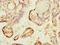 Glial Cells Missing Transcription Factor 1 antibody, LS-C675799, Lifespan Biosciences, Immunohistochemistry paraffin image 