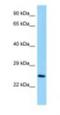 Collagen Triple Helix Repeat Containing 1 antibody, NBP1-98466, Novus Biologicals, Western Blot image 