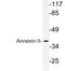 Annexin A2 antibody, LS-C177612, Lifespan Biosciences, Western Blot image 