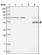 Cytochrome P450 Family 2 Subfamily E Member 1 antibody, NBP1-85366, Novus Biologicals, Western Blot image 