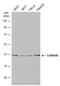 Translocase Of Outer Mitochondrial Membrane 40 antibody, GTX133772, GeneTex, Western Blot image 