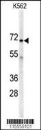 Adenylate Kinase 7 antibody, 62-640, ProSci, Western Blot image 