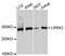 Leucine Rich Repeat Kinase 2 antibody, A10959, ABclonal Technology, Western Blot image 