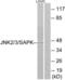 Mitogen-Activated Protein Kinase 8 antibody, LS-B7009, Lifespan Biosciences, Western Blot image 