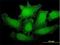 SMG1 antibody, H00023049-M01, Novus Biologicals, Immunofluorescence image 