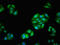 Fascin Actin-Bundling Protein 1 antibody, LS-C670153, Lifespan Biosciences, Immunofluorescence image 