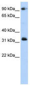 Coiled-Coil Domain Containing 69 antibody, TA333800, Origene, Western Blot image 