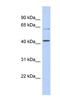 Solute Carrier Family 22 Member 12 antibody, NBP1-62526, Novus Biologicals, Western Blot image 