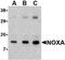 Phorbol-12-Myristate-13-Acetate-Induced Protein 1 antibody, 2437, ProSci, Western Blot image 