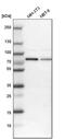 RNA Binding Motif Protein 14 antibody, PA5-52314, Invitrogen Antibodies, Western Blot image 