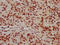 Histone Cluster 1 H1 Family Member C antibody, LS-C676860, Lifespan Biosciences, Immunohistochemistry paraffin image 