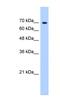 SURP And G-Patch Domain Containing 1 antibody, NBP1-57563, Novus Biologicals, Western Blot image 