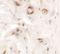 Uroplakin 1B antibody, A10230, Boster Biological Technology, Immunohistochemistry frozen image 