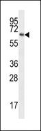 Transmembrane Phosphatase With Tensin Homology antibody, 62-481, ProSci, Western Blot image 