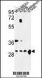 Tyrosine 3-Monooxygenase/Tryptophan 5-Monooxygenase Activation Protein Zeta antibody, MBS9207575, MyBioSource, Western Blot image 