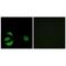Acyl-CoA Thioesterase 8 antibody, PA5-49970, Invitrogen Antibodies, Immunofluorescence image 