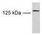 Transient Receptor Potential Cation Channel Subfamily M Member 8 antibody, NB200-145, Novus Biologicals, Western Blot image 